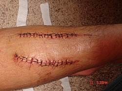 AZZ kicked by an APACHE!!!!-jeffs-cut-left-calf-6-10-06.jpg