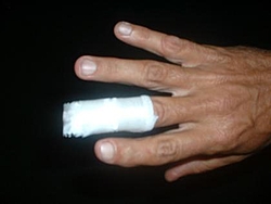 My tahoe bit me.-finger.jpg