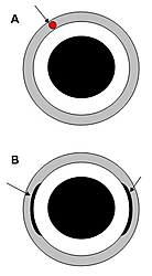 Gimble bearing removal-gimbalbearing.jpg