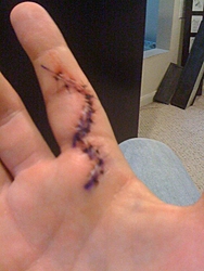 The B.S. Thread-finger.jpg