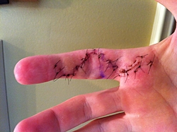 The B.S. Thread-finger.jpg